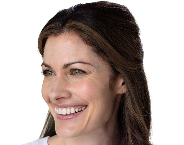 Before Aesthetic Botox Treatments for crows feet in Montreal