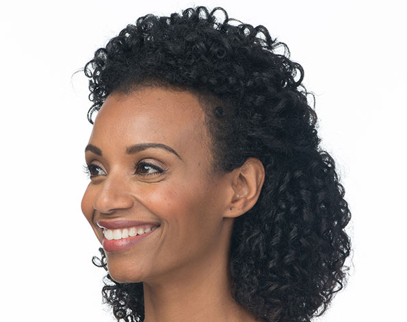 After Aesthetic Botox Treatments for crows feet in Montreal