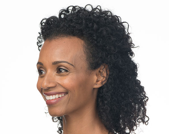 Before Aesthetic Botox Treatments for crows feet in Montreal