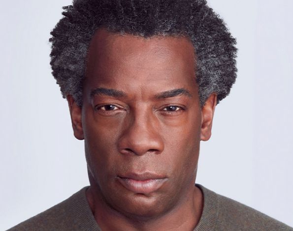 Before Aesthetic Botox Treatments for frown eyebrows in Montreal