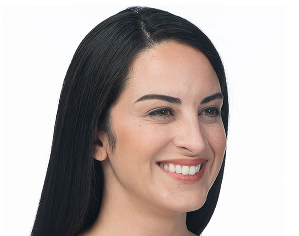 After Aesthetic Botox Treatments for crows feet in Montreal