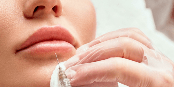 Dermal filler hyaluronic Acid Injections in Montreal