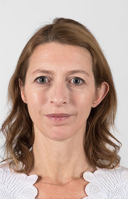 After Aesthetic Hyaluronic acid dermal fillers injectables in Montreal