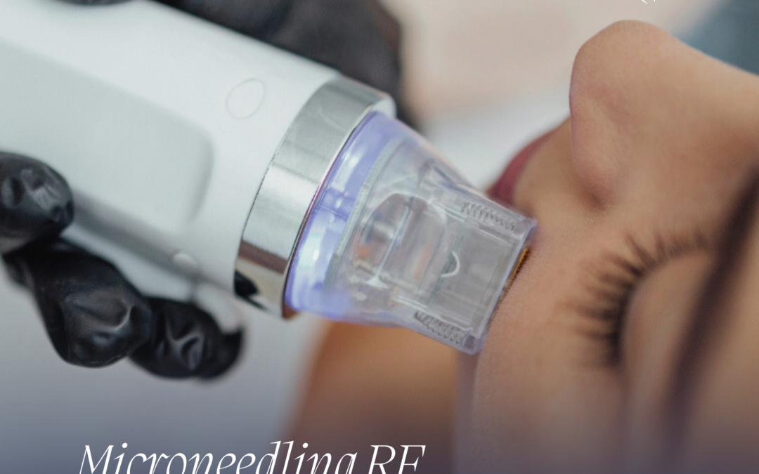 Libérer la Confiance : Le Secret derrière SECRET PRO à la Clinique Ideal Body