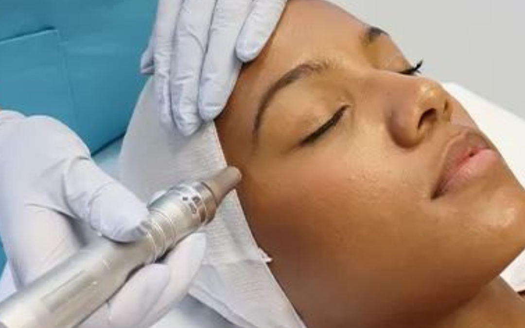 CryoPen vs. Plasma Pen: Which Treatment Is Right for Your Skin Concern?