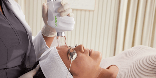 Avant/après traitement Secret™ PRO de Cutera à Montréal Traitement de resurfaçage au laser CO2 et de microneedling RF à la clinique Ideal Body