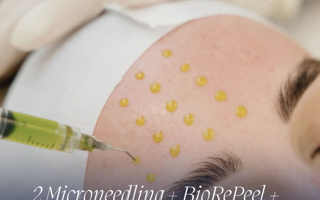 Say Goodbye to Skin Imperfections: Discover Clearer, Healthier Skin at Ideal Body Clinic