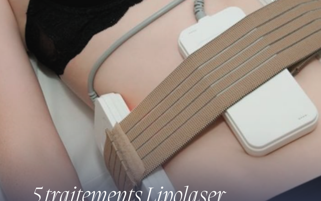 Ideal Body Clinic Memberships: Beauty, Wellness, and Value All Year Long