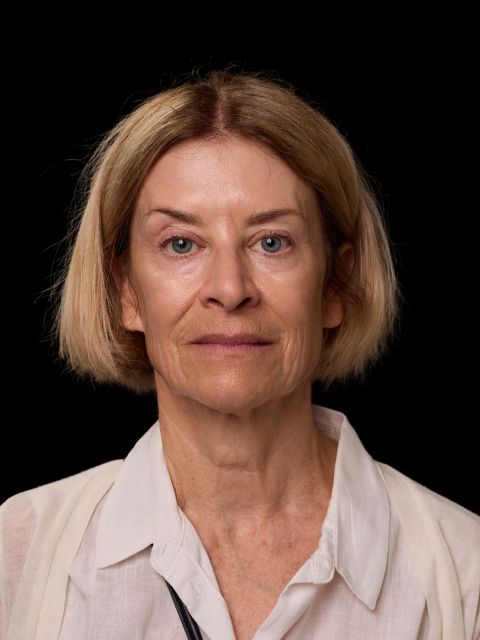 Before picture: triLift treatment for mature woman in Montreal at Ideal Body Clinic