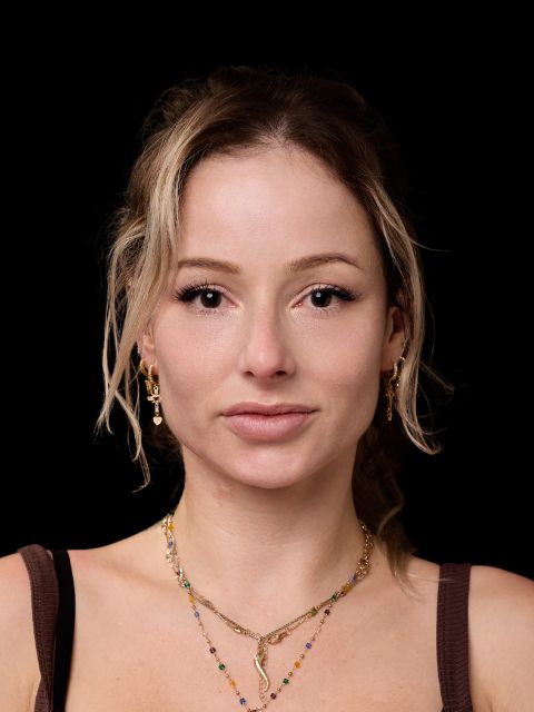 After picture: triLift  treatment at Ideal Body Clinic on young patient